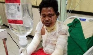 Tragis, Satpam Nekat Bakar Diri, Ini Alasannya