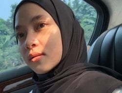 Nissa Sabyan Dikabarkan Operasi Plastik, Cek Faktanya!