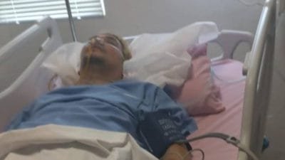 Diduga Alami Pendarahan Otak, Indra Bekti Jalani Operasi