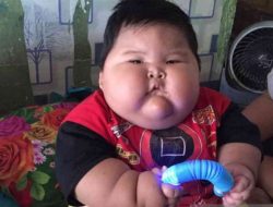 Menkes Siap Dampingi Balita Obesitas di Bekasi Dengan Perawatan