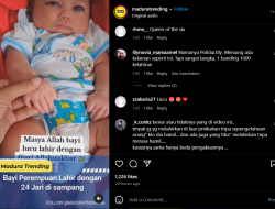 Bayi Lahir dengan 24 Jari di Tangan dan Kaki Viral di Media Sosial