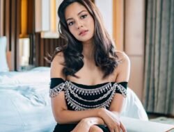 Aurelie Moeremans Alami Geger Otak Buntut Kecelakaan