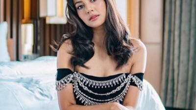 Aurelie Moeremans Alami Geger Otak Buntut Kecelakaan